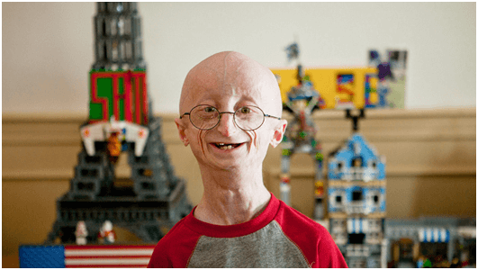 Sam Berns