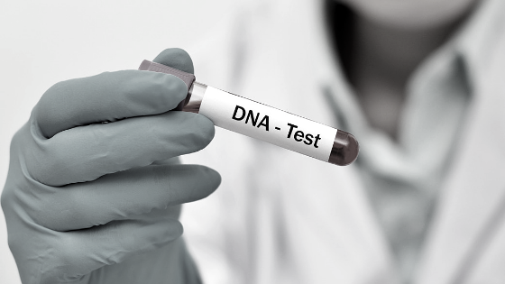 DNA test