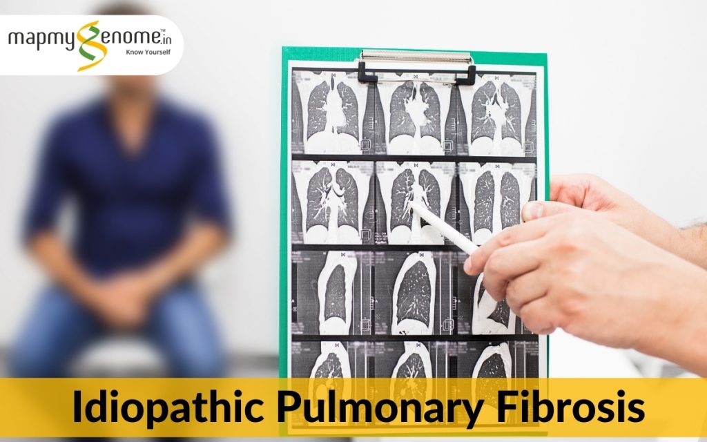  Idiopathic Pulmonary Fibrosis 